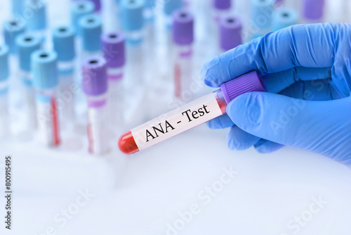 Doctor holding a test blood sample tube with ANA test on the background of medical test tubes with analyzes.