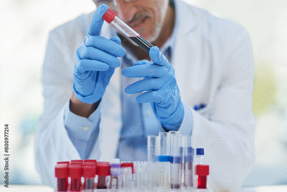 Science, blood and hands of man with test tube for biotech engineering, pathology and hematology research. Laboratory, investigation and scientist checking diabetes drugs development in medical study Science, blood and hands of man with test tube for biotech engineering, pathology and hematology research. Laboratory, investigation and scientist checking diabetes drugs development in medical study