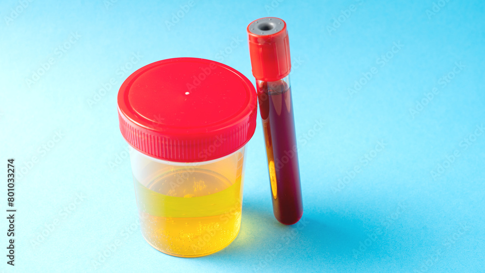 Urine and blood test in container and test tube on blue background close-up. Urine and blood test in container and test tube on blue background close-up.