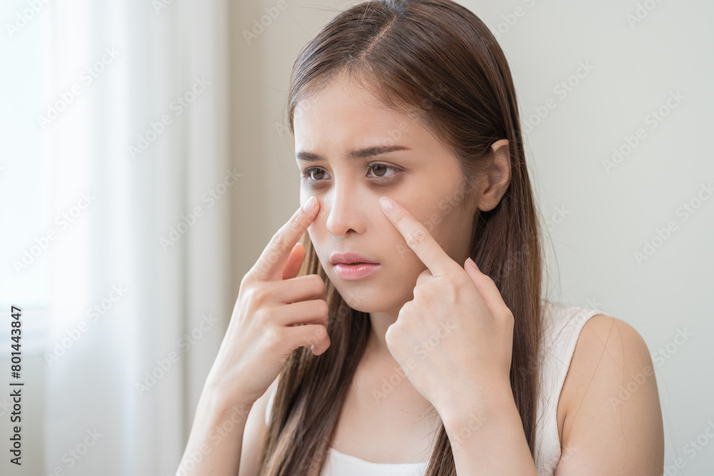 Bored, insomnia asian young woman, girl looking at camera, hand touching under eyes with problem of black circles or panda puffy, swollen and wrinkle on face. Sleepless, sleepy healthcare person. Bored, insomnia asian young woman, girl looking at camera, hand touching under eyes with problem of black circles or panda puffy, swollen and wrinkle on face. Sleepless, sleepy healthcare person.