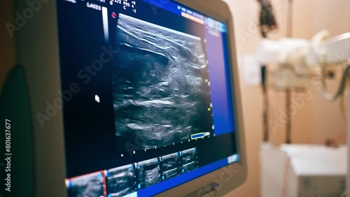 close-up in veterinary clinic screening on an abdominal ultrasound monitor photo