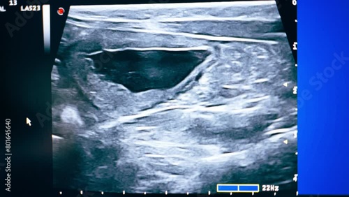 close-up in veterinary clinic screening on an abdominal ultrasound monitor