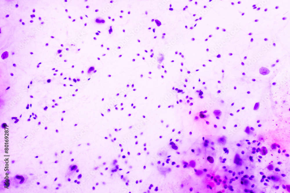 Human sperms viewed in the microscopic for male fertility test.Spermatozoa on white background.Reproductive system check.Donor suitability test for artificial insemination.Semen analysis. Human sperms viewed in the microscopic for male fertility test.Spermatozoa on white background.Reproductive system check.Donor suitability test for artificial insemination.Semen analysis.