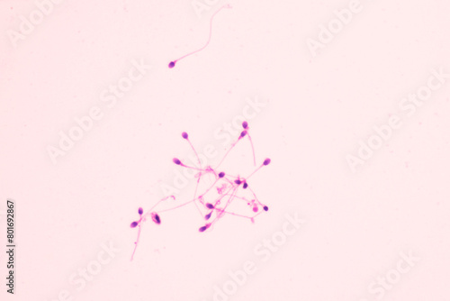 Human sperms viewed in the microscopic for male fertility test.Spermatozoa on white background.Reproductive system check.Donor suitability test for artificial insemination.Semen analysis. © arcyto