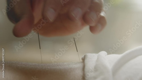A Man Touching Acupuncture Needles