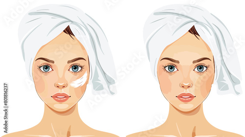 Young woman before and after facial cleansing procedure