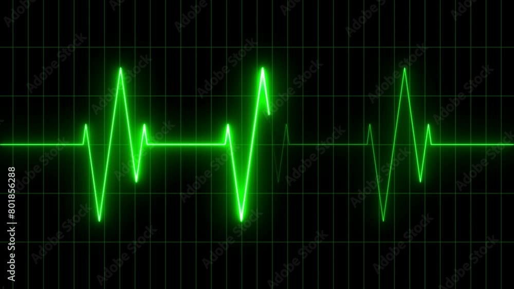 Heart Rate Monitor Pulse Rate Motion Loop background Heart Rate Monitor Pulse Rate Motion Loop background