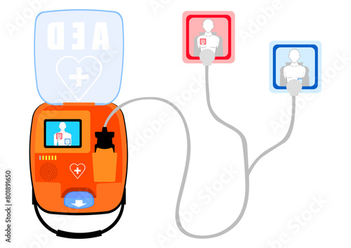 AED 自動体外式除細動器を準備する