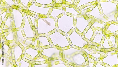 The water net  Hydrodictyon sp  under microscope. Collected from paddy fields in Indonesia. 
