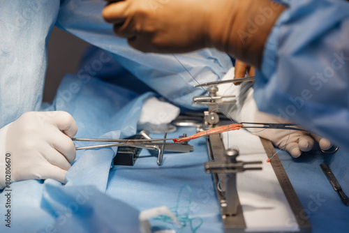 surgeons work on the cut part of the knee joint (muscular ligament). Arthroscopic anterior cruciate ligament reconstruction photo