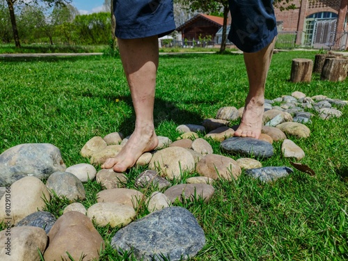 Close-up on the feet of a Caucasian man engaged in a barefoot path: a stretch of rounded stones follows wooden trunks on a meadow. Beautiful sunny day.