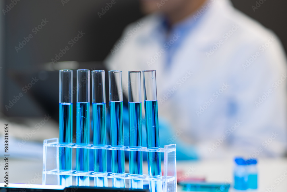 Scientists test the chemical reactions of the colored liquid solution and test biological fluids in test tubes. Scientists test the chemical reactions of the colored liquid solution and test biological fluids in test tubes.