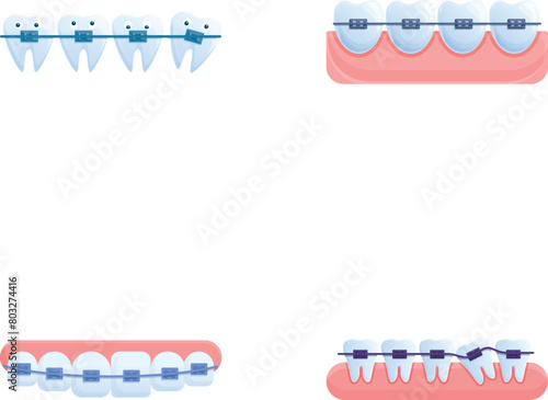 Orthodontic treatment icons set cartoon vector. Various brace system on teeth. Bite correction