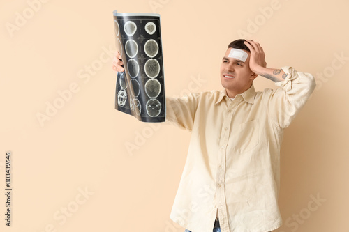 Young man with brain concus...