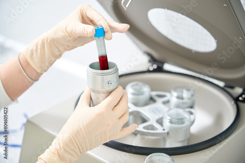 Photos Nurse preparing blood sample for plasma separation in special centrifuge