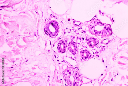 Photos Backgrounds of human cells tissue of cervix under the microscope in pathology lab