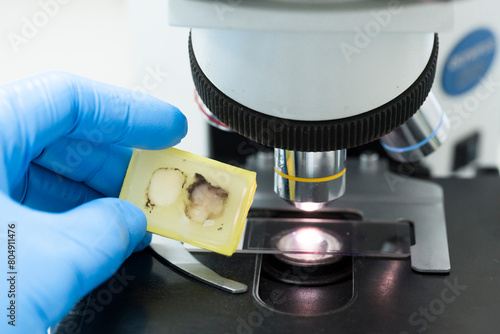 Fotografie Scientist wear blue glove holding paraffin human tissue block and out of focus microscope