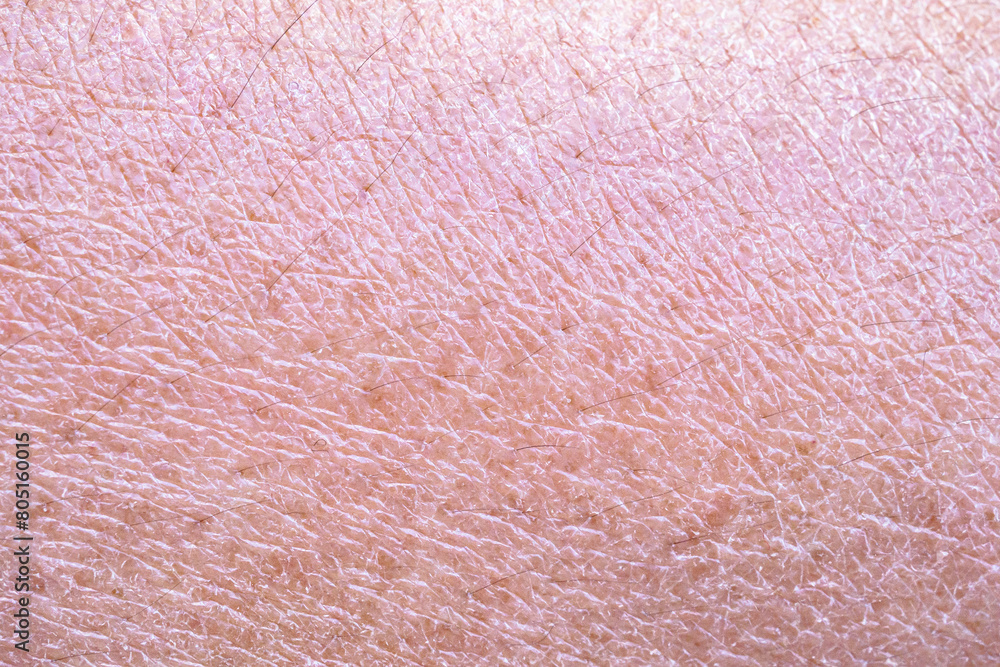 dry and dehydrated human skin texture background Stock Photo | Adobe Stock