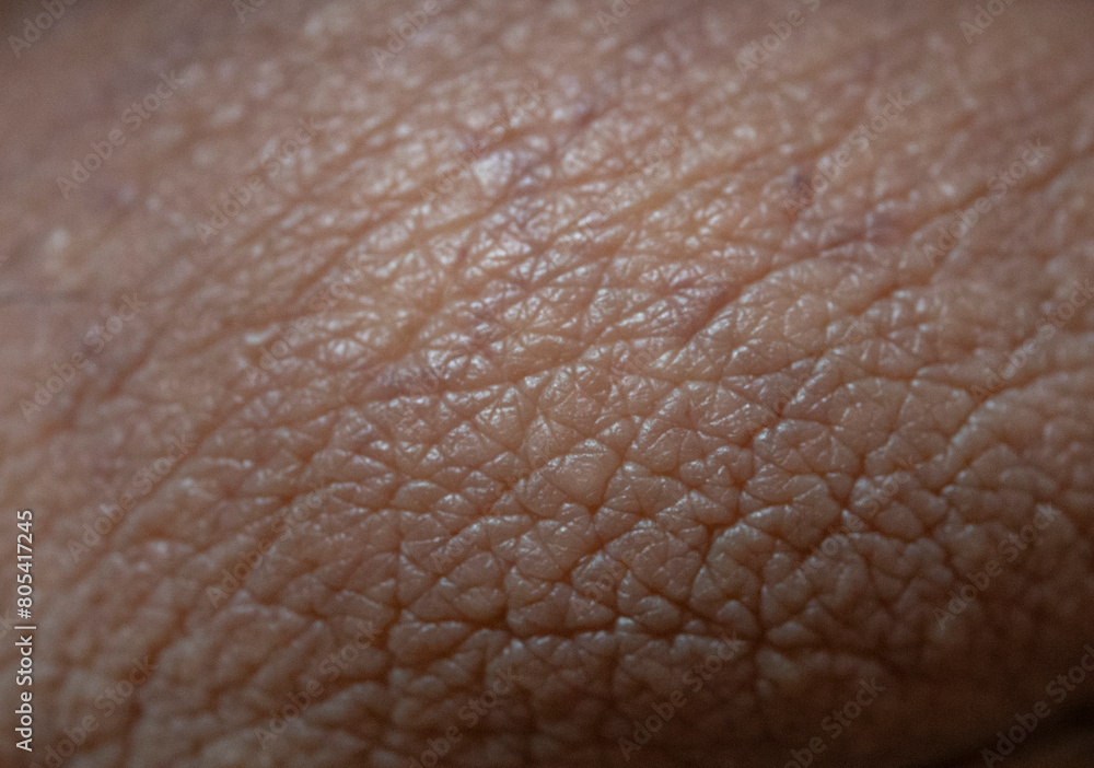 Human skin folds Human skin folds