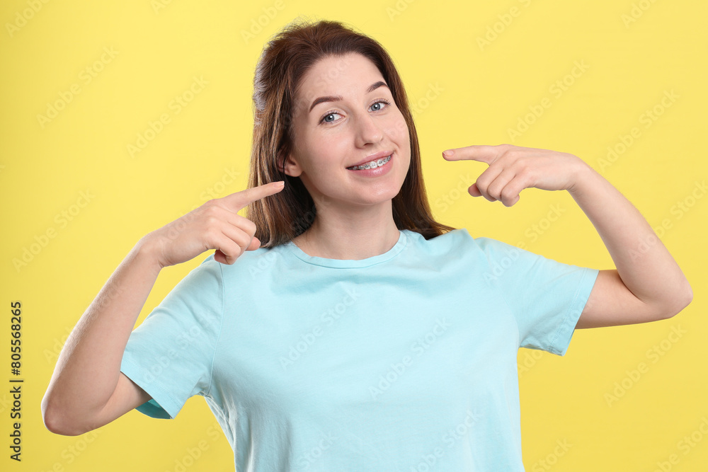 Portrait of smiling woman pointing at her dental braces on yellow background Portrait of smiling woman pointing at her dental braces on yellow background
