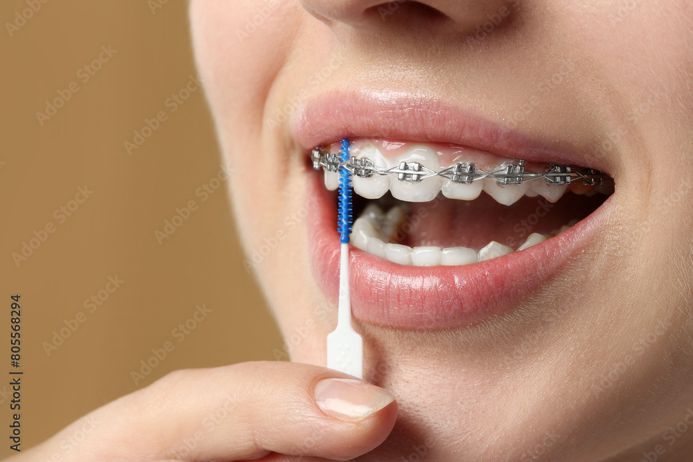 Obraz premium Woman with dental braces cleaning teeth using interdental brush on beige background, closeup