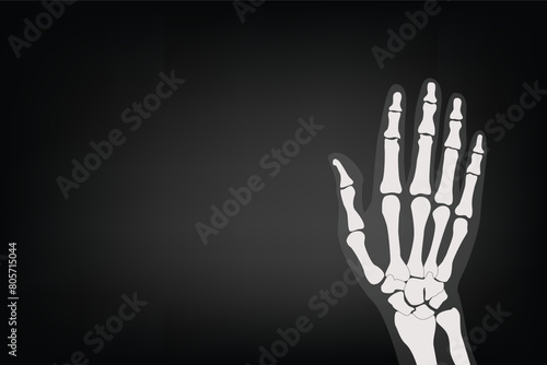 Anatomy and body part: X-ray hand of human 