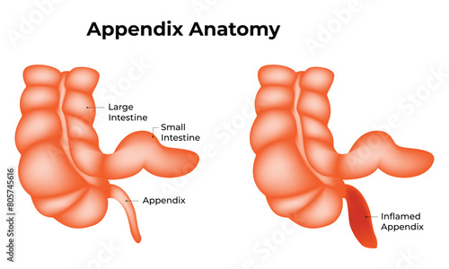 Appendix Anatomy Science Design Vector Illustration Diagram