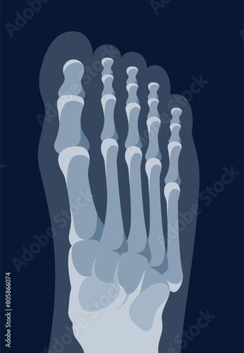 Human foot xray leg bone structure medical diagnostic top view vector flat illustration