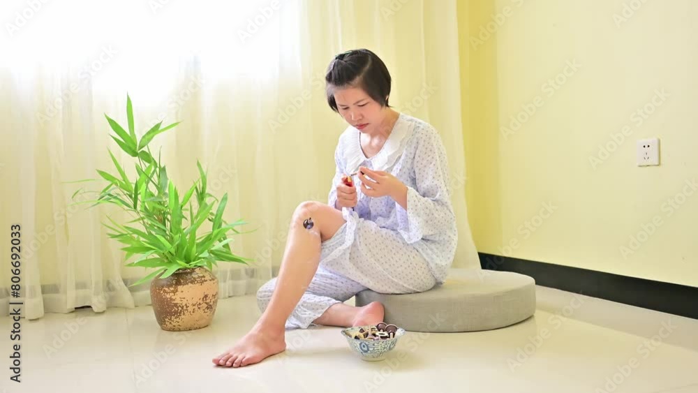 A Chinese woman is doing moxibustion therapy A Chinese woman is doing moxibustion therapy