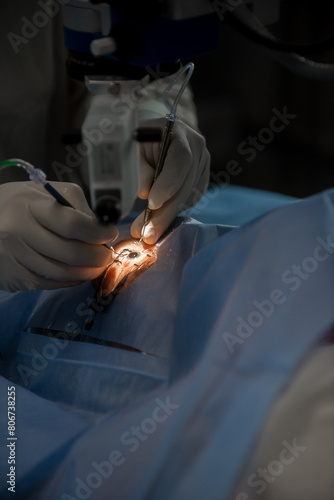 Doctor eye surgery. A close-up of the work of an ophthalmologist, behind the laser eye microsurgery apparatus. A doctor using a microsurgical instrument performs an operation on the patients eyes