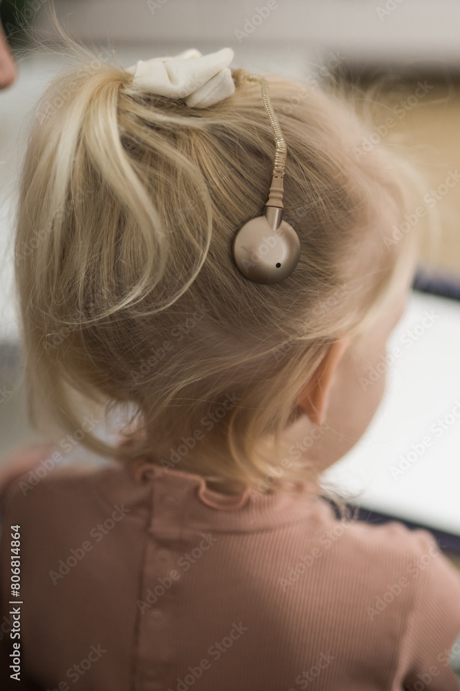 Fototapeta premium Close-up back view baby with cochlear implant. Hear aid and medicine innovating technology and diversity concept