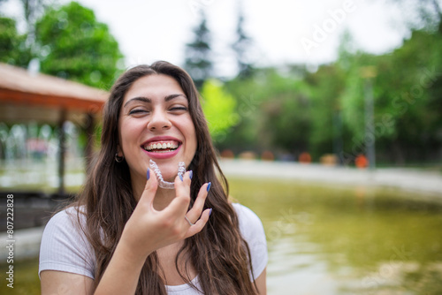 Wallpaper Mural Beautiful Smiling Turkish Woman with invisible teeth bracket aligner Torontodigital.ca