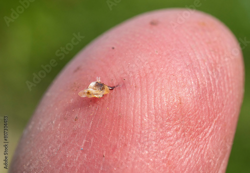 A bee stung a mans finger. 
