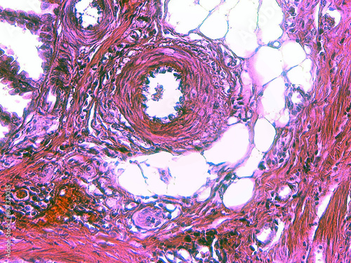 Obraz na płótnie photo of cross section in small intestine jejunum as seen by the microscope
