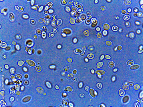 photo of fungi spores and mycelium under the microscope