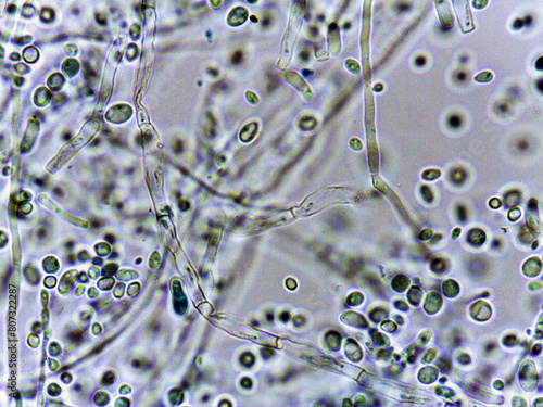 Fotografie photo of fungi spores and mycelium under the microscope
