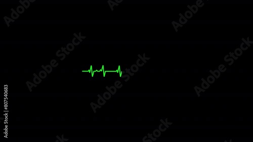 Heart rate monitoring Animation, Heart rate monitor, Heart beat pulse in green, heart stops beating, Seamlessly loop footage. photo