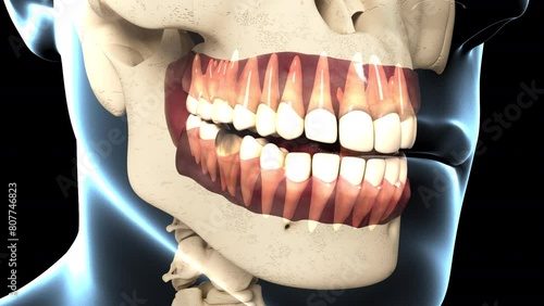 Dental Caries Overview