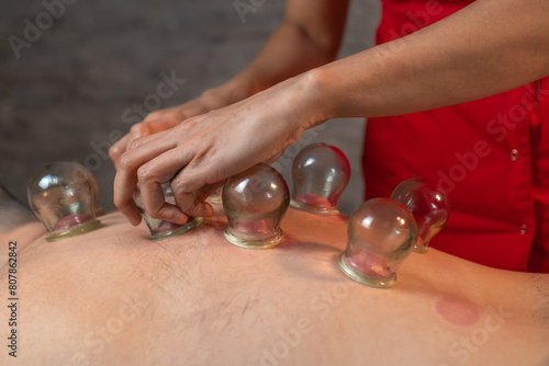 Wallpaper Mural Close-up of the masseur's hands placing glass jars on the man's back. Massage with glass vacuum jars. Close-up of a man lying with cans on his back in a spa. Vacuum therapy. Massage with jars. Torontodigital.ca