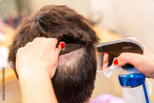 Foto Hairstylist removing the capillary prosthesis of a man