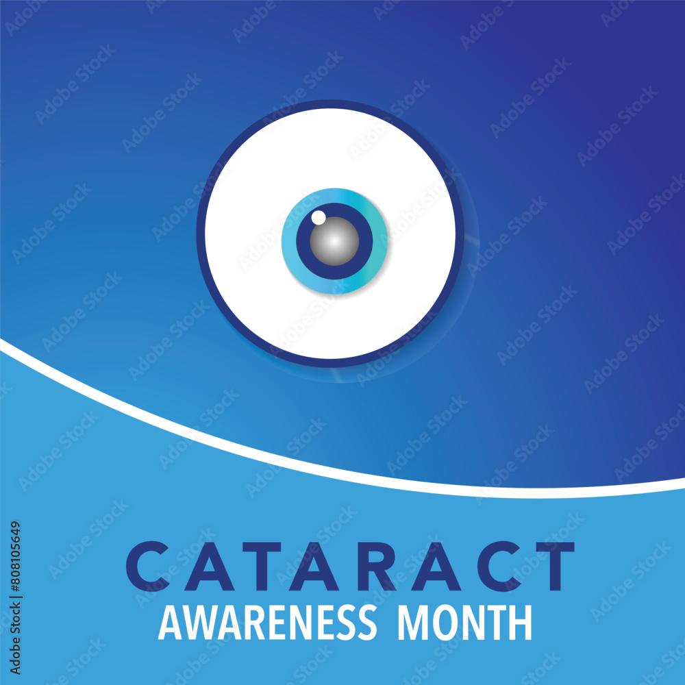Cataract awareness month is observed every year in June, it is a dense, cloudy area that forms in the lens of the eye. Vector illustration. Cataract awareness month is observed every year in June, it is a dense, cloudy area that forms in the lens of the eye. Vector illustration.