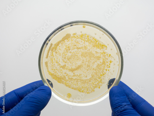 Microscopic colonies of bacteria on the medium in a petra dish.