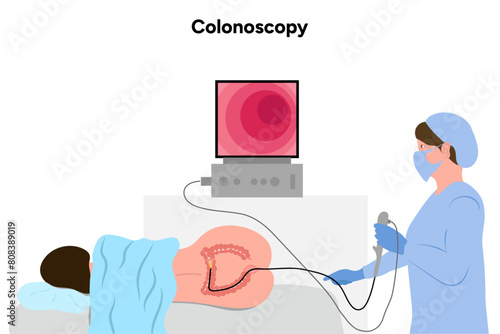 Colonoscopy procedure with patient and doctor 