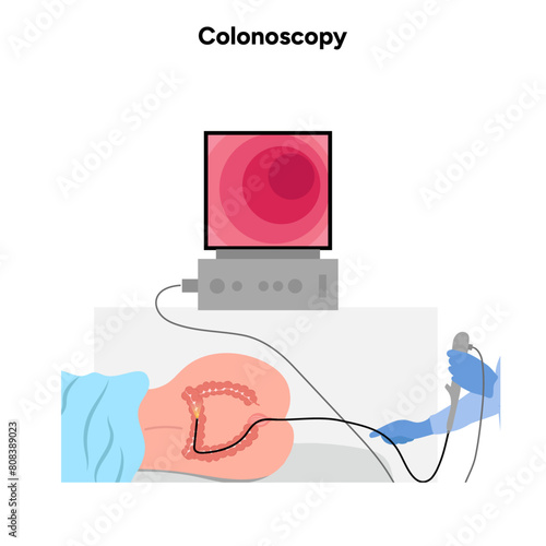 Colonoscopy procedure diagram gastroscopy with endoscope 