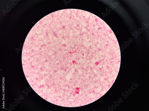 red bacteria cell branching in hemoculture.