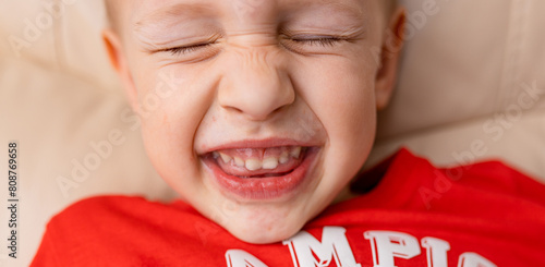 Close-up of a smiling boy's face with red spots near the mouth, atopic dermatitis, allergies, rash and irritation