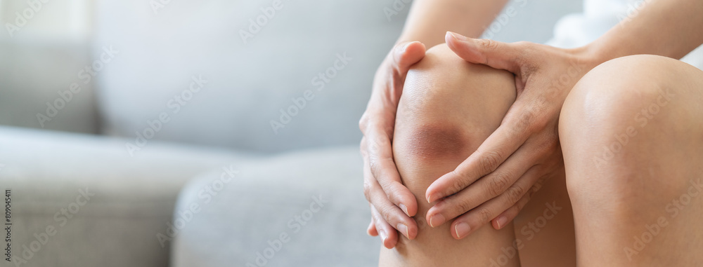 people get body injured concept, Close-up person got bruised on the knee. people get body injured concept, Close-up person got bruised on the knee.