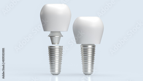 The dental implants for health and medical concept 3d rendering.