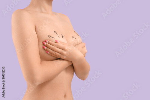 Naked young woman with marks on her breasts against lilac background, closeup. Plastic surgery concept