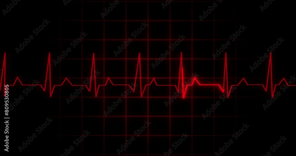 EKG Heartbeat reading animation on black background in 4K. Medical monitor displaying cardiography pulse checkup diagnosis electronic screen display machine. Cardiogram nubes rate ecg waveform surger
EKG Heartbeat reading animation on black background in 4K. Medical monitor displaying cardiography pulse checkup diagnosis electronic screen display machine. Cardiogram nubes rate ecg waveform surger